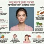 Natural acne solutions and expert advice