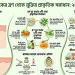 Natural solutions for acne on oily skin